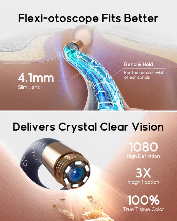2025 New  Earsight plus I35R Visual Ear Cleaner Earpick Bendable HD Clipable Tweezers All-In-1 Ear Rod Earwax Removal Kits